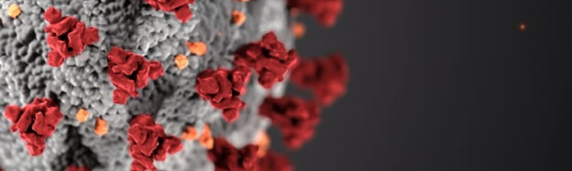 032420 UCCU_COVID-19 SKIP_HomepageBanner close up picture of a bacteria